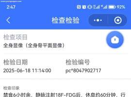 父亲肺鳞癌，cT3N0M1a，ⅣA，脑转移，每天害怕，请求在心理和治疗方面的帮助