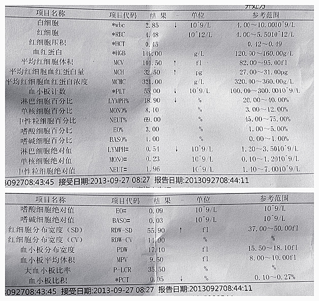 9月下旬放疗后