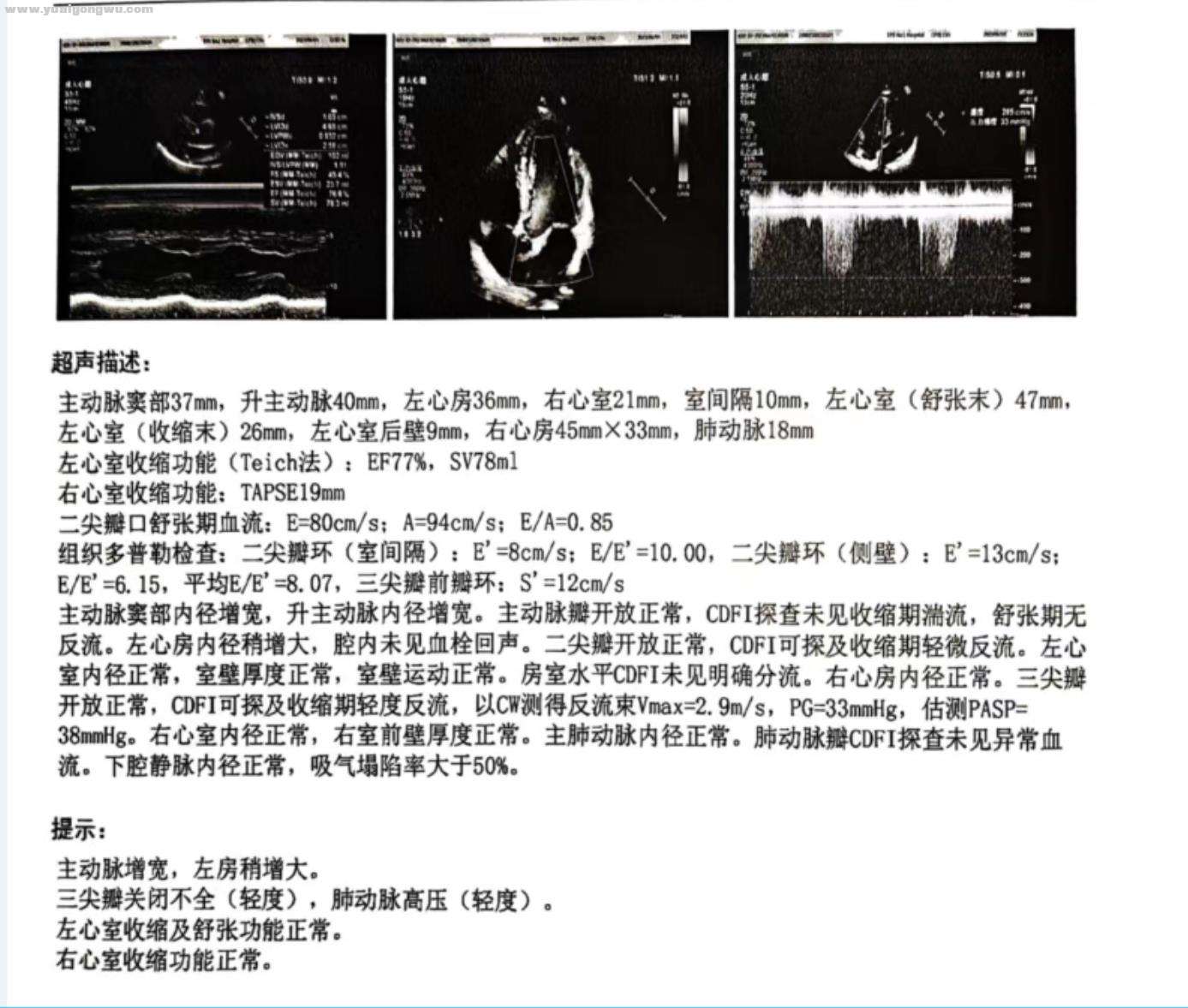 6月5日超声检查报告单.jpg